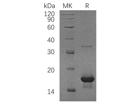 Human SH2D1A/SAP Recombinant Protein (RPES3073)