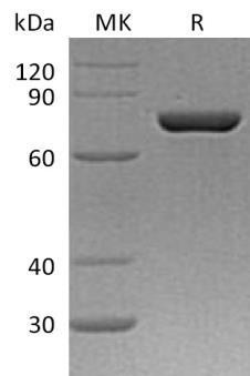 Human ERP72/PDIA4 Recombinant Protein (RPES3086)