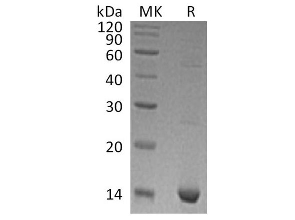 Human S100A9 Recombinant Protein (RPES3092)