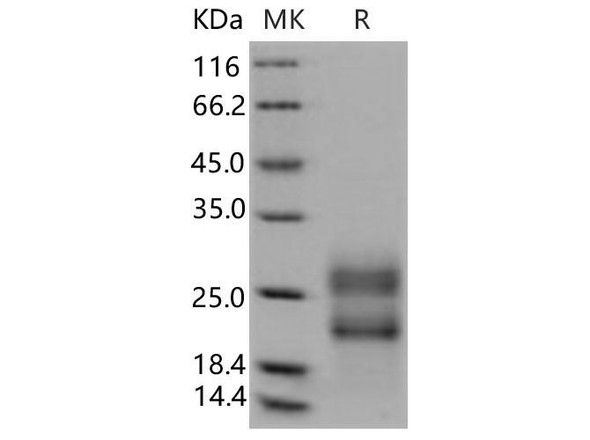 Human RSPO3 Recombinant Protein (aa 146, His Tag) (Active) (RPES3138)