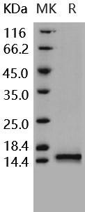 Human Cystatin B/CSTB Recombinant Protein (His Tag) (Active) (RPES3235)