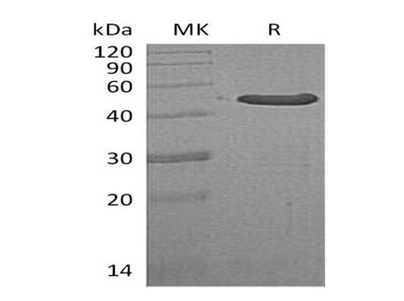 Human WDYHV1/NTAQ1 Recombinant Protein (RPES3244)