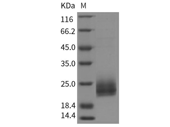 Rat NPC2 Recombinant Protein (His Tag) (RPES3257)