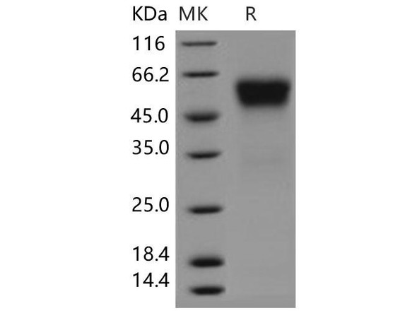 Human sFRP4 Recombinant Protein (His Tag) (Active) (RPES3261)