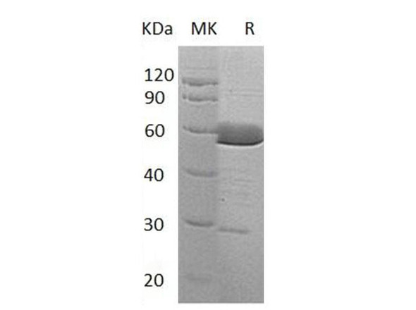 Human Alpha-Parvin/PARVA Recombinant Protein (RPES3266)