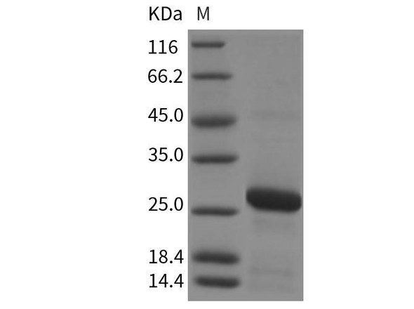 Rat RAB7A/Rab-7a Recombinant Protein (His Tag) (RPES3277)
