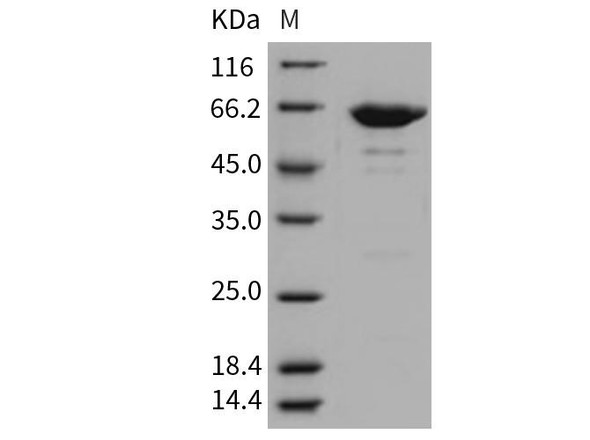 Mouse LTA4H Recombinant Protein (His Tag) (Active) (RPES3299)