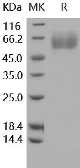 Human MSR1/SCARA1/CD204 Recombinant Protein (His Tag) (RPES3337)