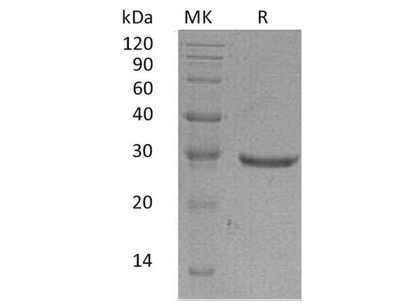 Human GLIPR1 Recombinant Protein (RPES3409)