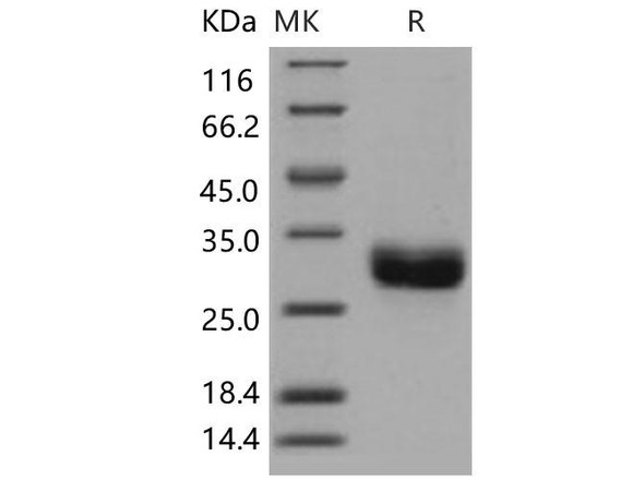 Human ULBP1/N2DL1 Recombinant Protein (His Tag) (Active) (RPES3461)