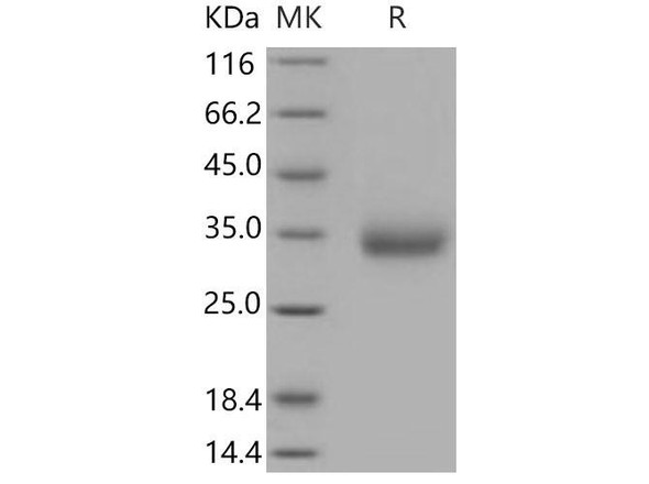 Mouse VSIG4 Recombinant Protein (His Tag) (RPES3467)