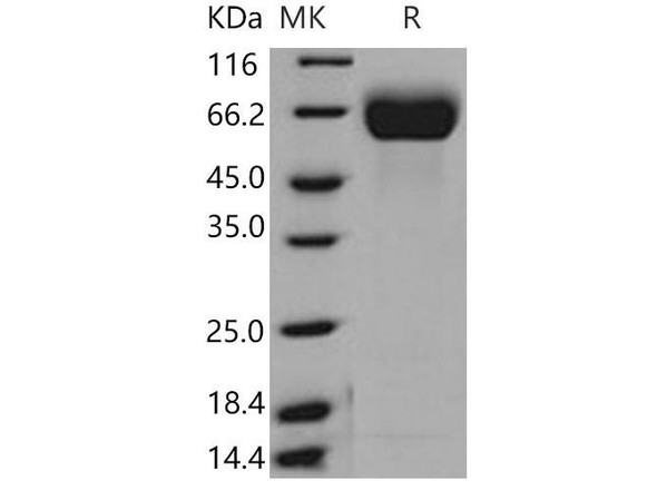Mouse FGFR1/CD331 Recombinant Protein (His Tag) (RPES3488)