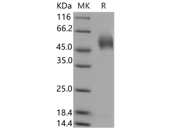 Human LSAMP Recombinant Protein (His Tag) (RPES3496)