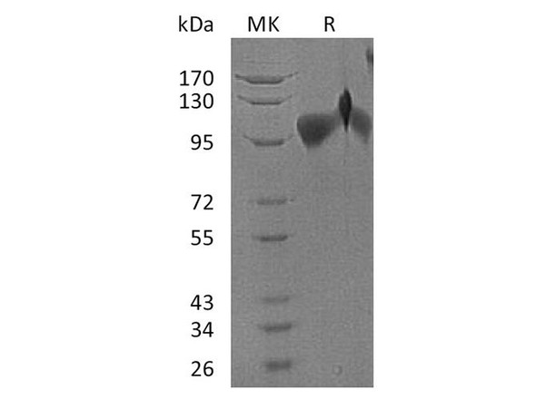 Human BMPR2 Recombinant Protein (RPES3503)