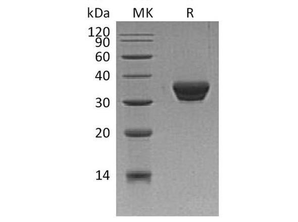 Human ASAM Recombinant Protein (RPES3533)