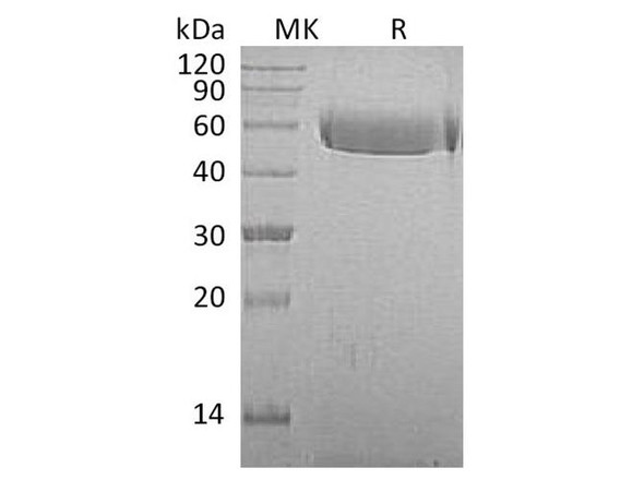 Macaca mulatta AHSG/Fetuin A Recombinant Protein (RPES3556)