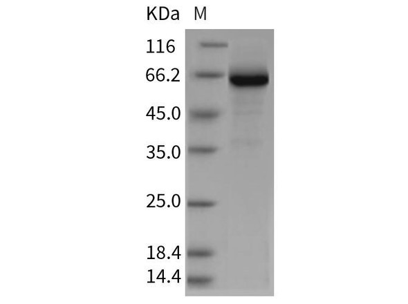 Rat GP1BB/CD42c Recombinant Protein (Fc Tag) (RPES3561)