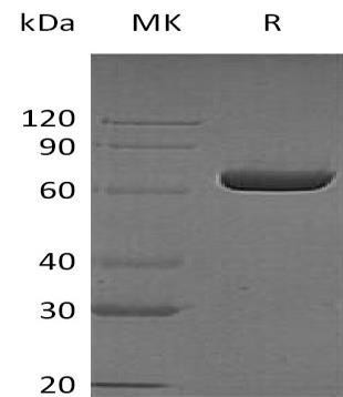 Human LTA4H Recombinant Protein (RPES3568)