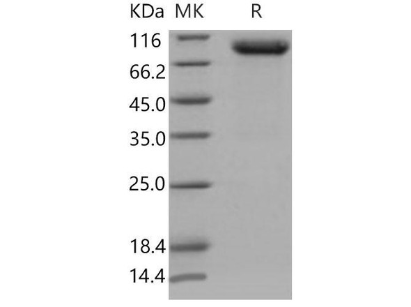 Mouse PLAUR/uPAR Recombinant Protein (RPES3571)