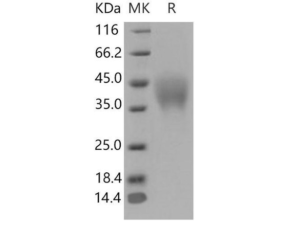 Mouse PILR-alpha/PILRA Recombinant Protein (His Tag) (Active) (RPES3584)