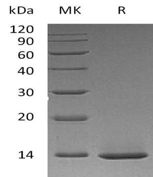 Human beta-NGF/NGFB Recombinant Protein (aa 122-241, E. coli) (Active) (RPES3591)