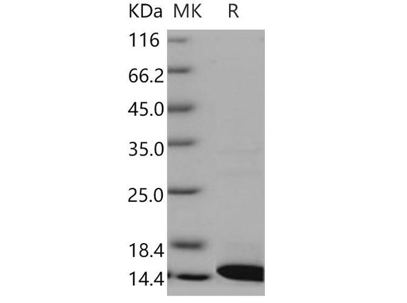 Human COX5B Recombinant Protein (His Tag) (RPES3598)