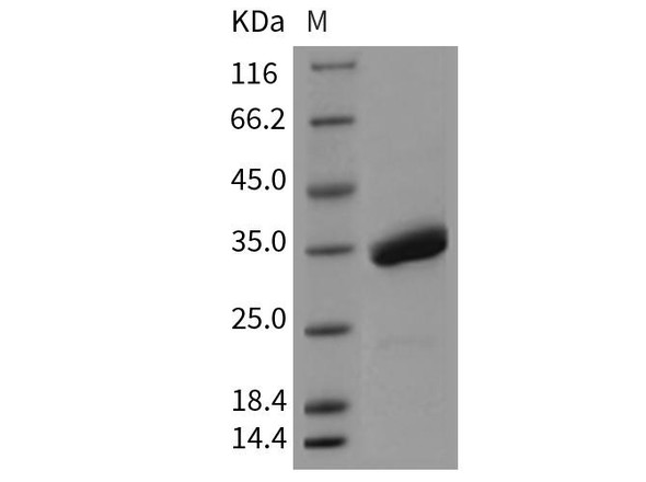 Mouse SPINK4 Recombinant Protein (Fc Tag) (RPES3624)