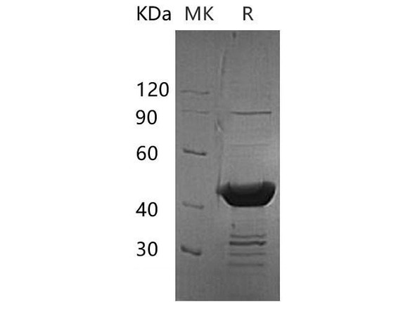 Human BUP1 Recombinant Protein (RPES3632)