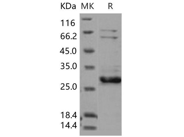 Human XIAP/BIRC4 Recombinant Protein (AVI Tag) (Active) (RPES3648)
