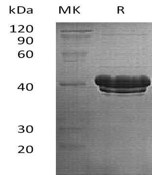 Bridging Integrator 2/BIN2 Recombinant Protein (RPES3649)