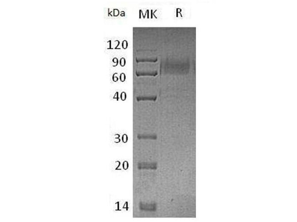 Mouse TYRO3/DTK Recombinant Protein (RPES3655)