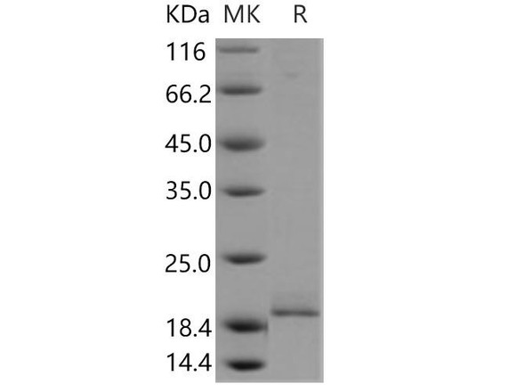 Human PPP3R1 Recombinant Protein (His Tag) (Active) (RPES3670)