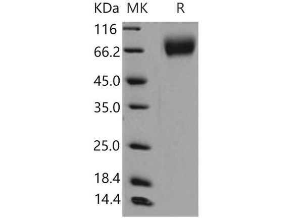 Mouse TrkB/NTRK2 Recombinant Protein (His Tag) (Active) (RPES3677)