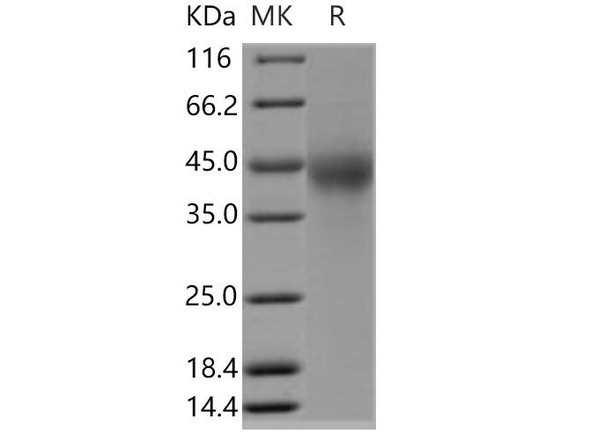 Human TMUB2 Recombinant Protein (His Tag) (RPES3692)