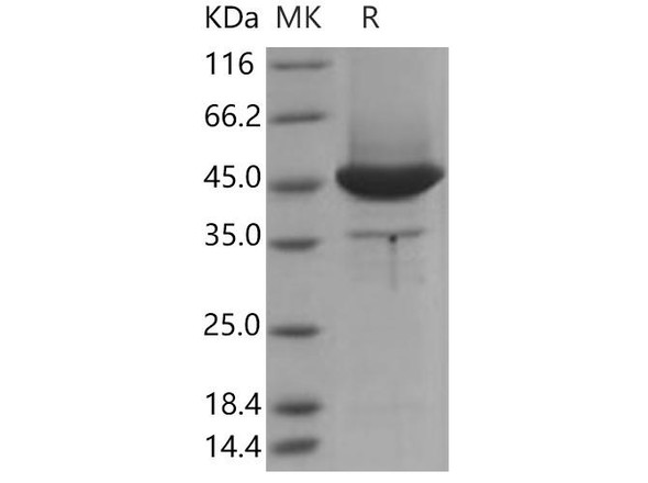 Human MSN/Moesin Recombinant Protein (aa 1-346, His Tag) (RPES3713)