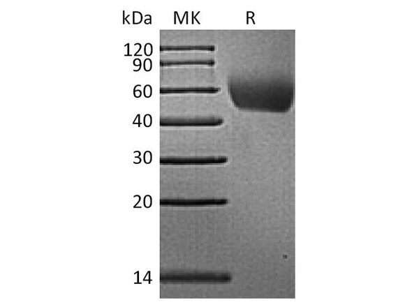Rhesus macaque CD155/NECL5 Recombinant Protein (RPES3726)