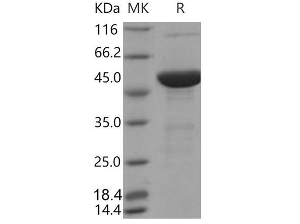 Mouse S100A15/S100A7A Recombinant Protein (His & MBP Tag) (RPES3733)