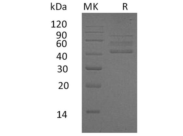 Human RELT/TNFRSF19L Recombinant Protein (RPES3745)