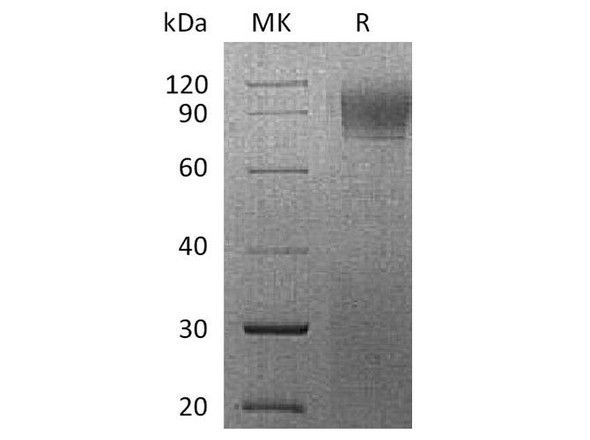 Rhesus macaque IFNAR1 Recombinant Protein (RPES3770)