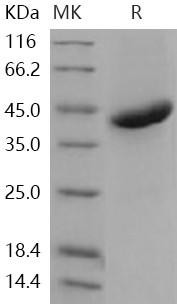 Human R-Spondin 1/RSPO1 Recombinant Protein (His Tag) (Active) (RPES3773)