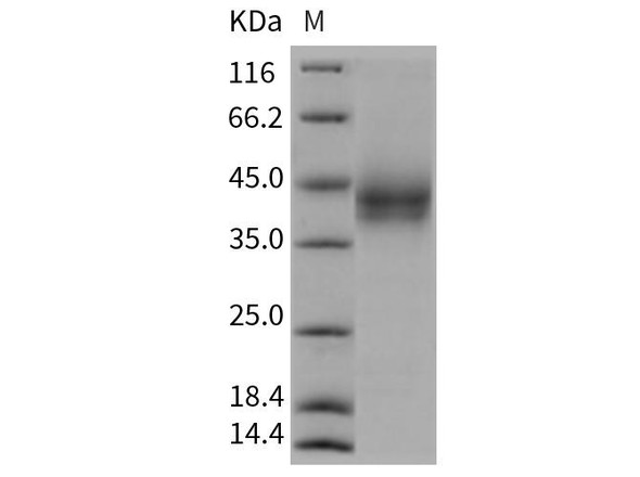 Rat B7-H3/CD276 Recombinant Protein (His Tag) (RPES3796)