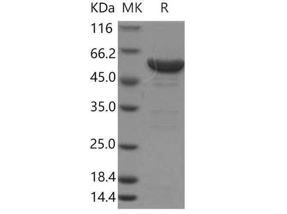Human LAP3/Cytosol Aminopeptidase Recombinant Protein (His Tag) (RPES3814)