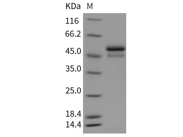 Mouse SerpinI1/Neuroserpin Recombinant Protein (His Tag) (RPES3818)