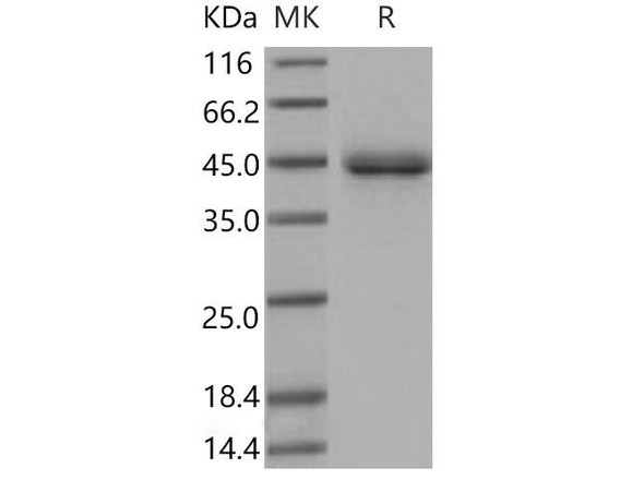 Mouse SFTPD/SP-D Recombinant Protein (His Tag) (RPES3862)