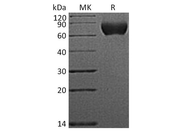 Human Nogo Receptor/NgR Recombinant Protein (RPES3875)