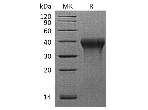Rhesus macaque CD27/TNFRSF7 Recombinant Protein (RPES3878)