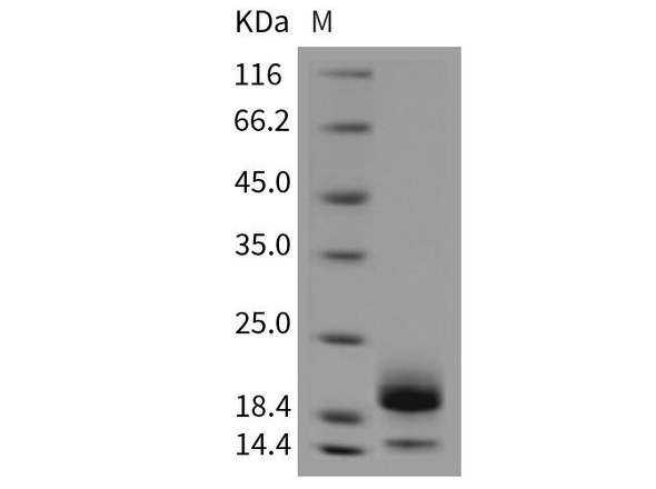 Mouse Cystatin E/CST6 Recombinant Protein (RPES3884)