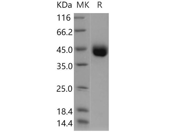 Human IZUMO1 Recombinant Protein (His Tag) (RPES3886)