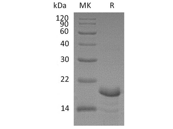 Human Calcineurin B/CNB Recombinant Protein (RPES3888)