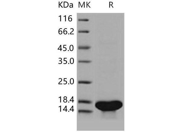 Human TrkA/NTRK1 Recombinant Protein (aa 285-413, His Tag) (RPES3903)